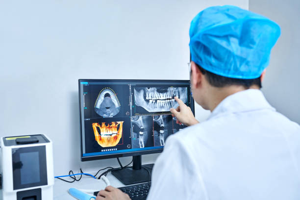Best Chipped Tooth Repair Near Me  in Butler Beach, FL